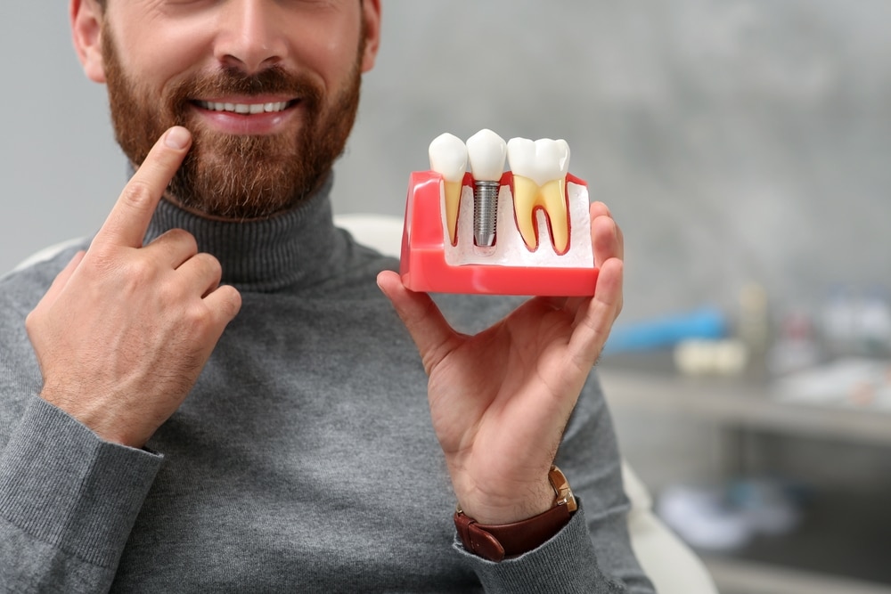 Dental Implants in Sherman Oaks